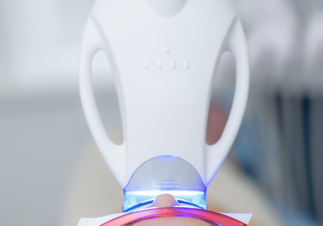 The Girl Undergoes The Procedure Of Teeth Whitenin 2025 10 15 21 49 47 Utc