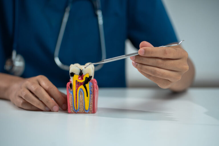 dentist explaining root canal treatment in Bulleen - Smile Style Dental Bulleen